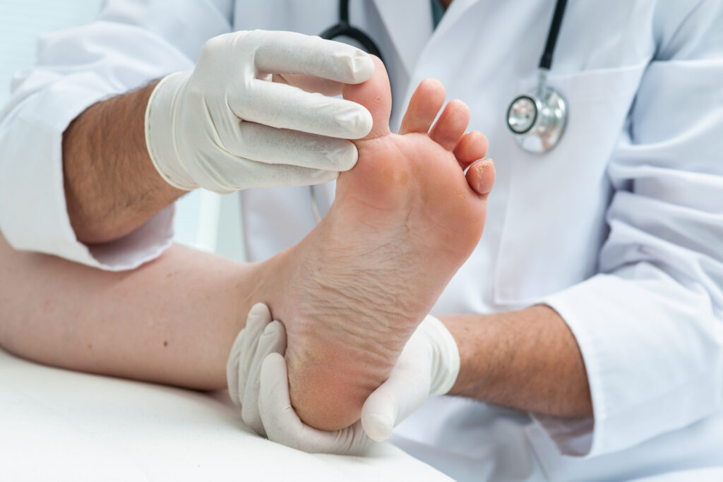 Doctor checking toes on foot